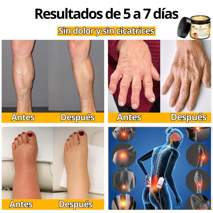 🐝Bee Venom Bswell - Crema Para Dolores con Veneno de Abeja